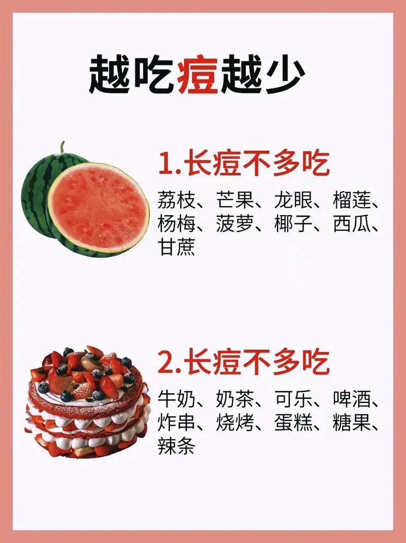 长痘痘饮食应该注意什么