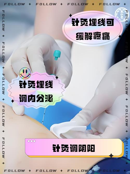 中医埋线的线有副作用