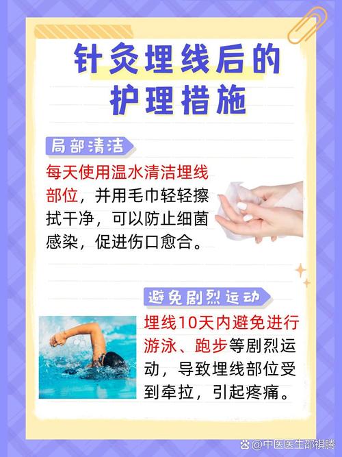 中医埋线的线有副作用