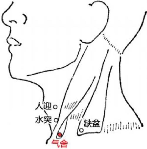 急性咽炎穴位治疗方法
