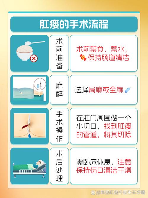 中医院怎么做肛瘘手术