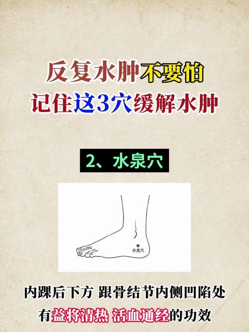 下肢水肿针灸哪些穴位