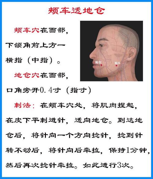 面瘫穴位注射效果好吗