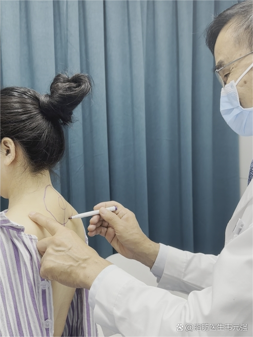 面瘫穴位注射效果好吗