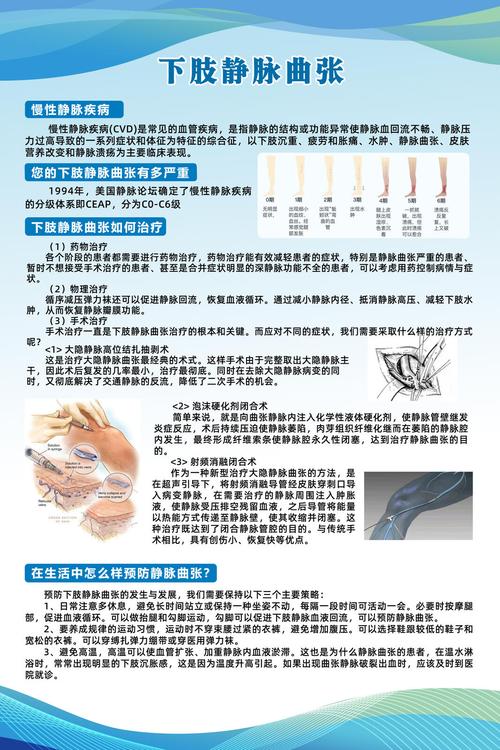 下肢静脉曲张中医病名