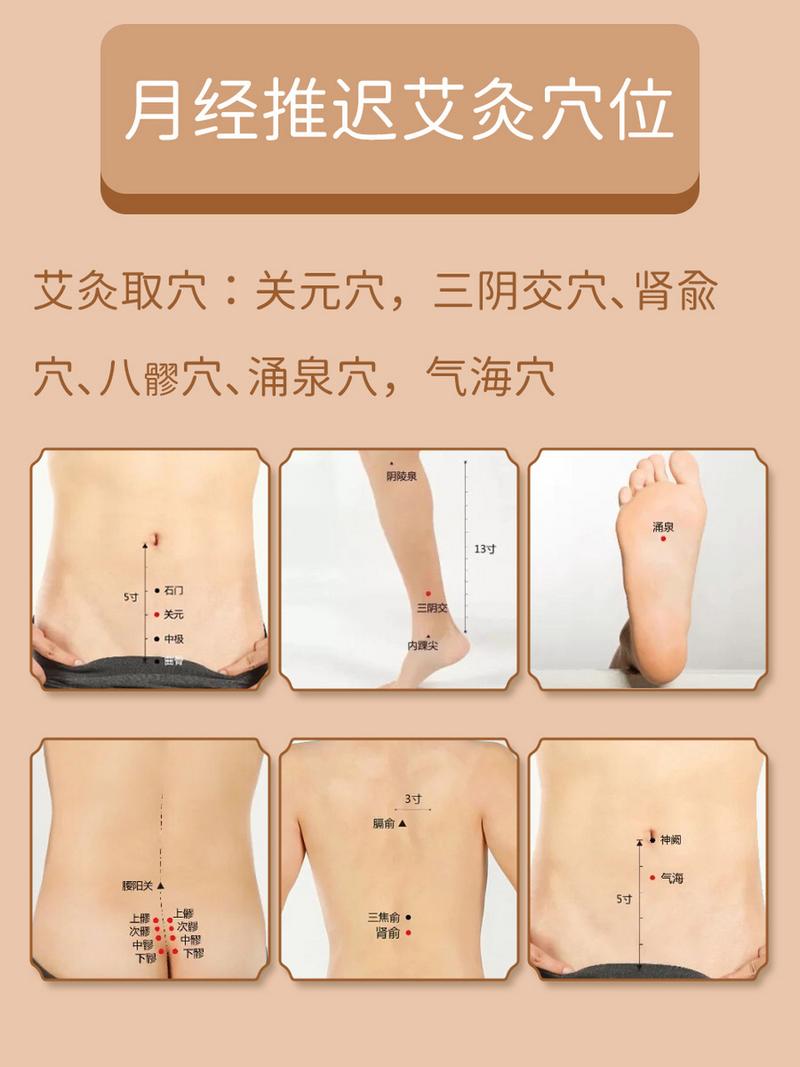 治疗月经提前艾灸穴位