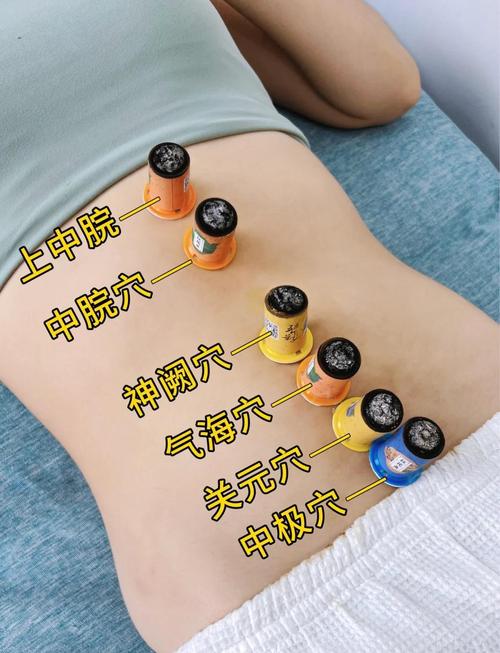 腹部胀满艾炙什么穴位