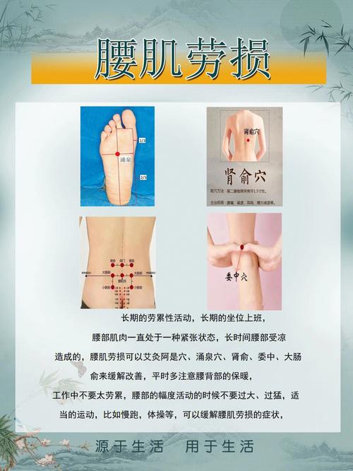 腰肌劳损要按什么穴位