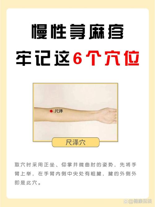 哪些穴位可以治疗过敏