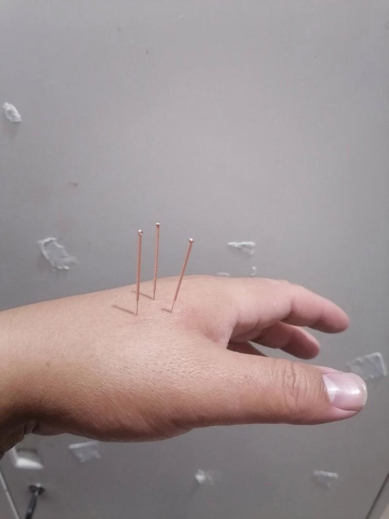 气血不通针灸什么穴位