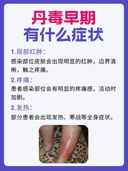 丹毒的饮食和饮食禁忌