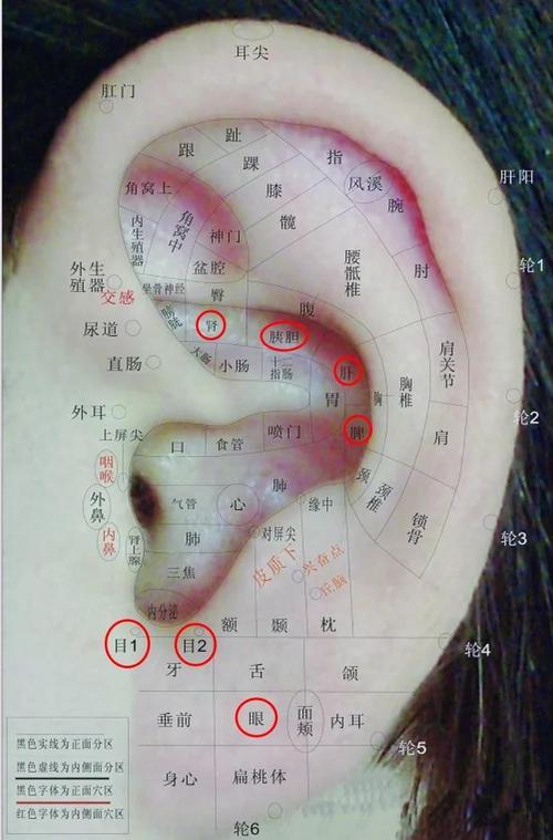 耳朵对折顶端穴位针刺