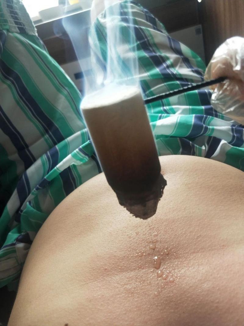 哪些穴位可以治疗出汗