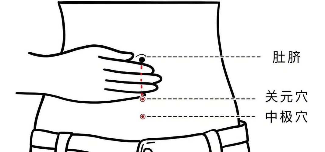 小儿遗尿艾灸哪个穴位