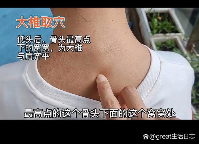 感冒咳嗽针灸哪个穴位