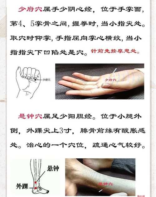 哪些穴位可以治疗痛风