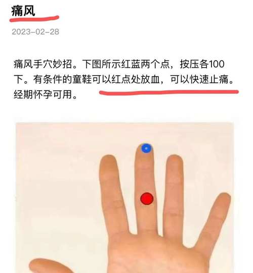 哪些穴位可以治疗痛风