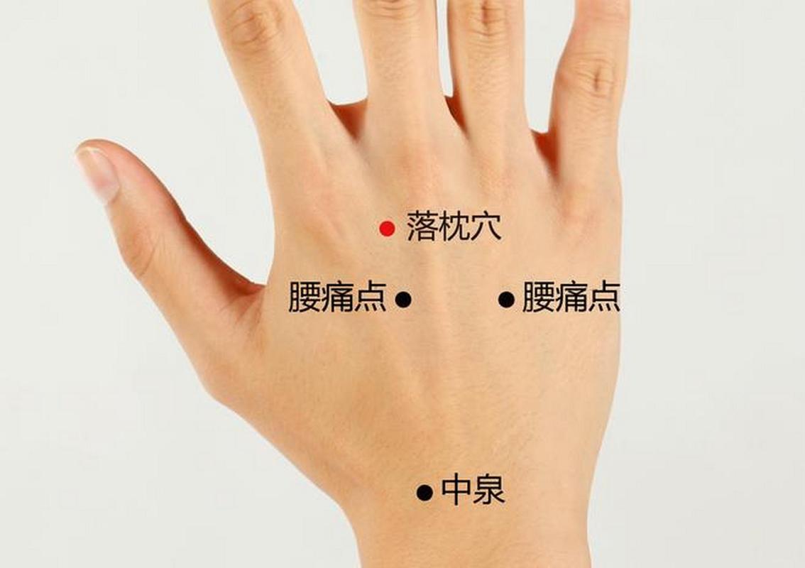 睡觉落枕针刺哪些穴位