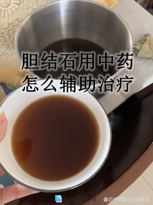 胆结石的中医治疗方法