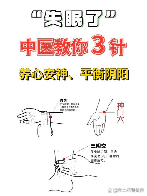 血虚失眠针灸哪些穴位