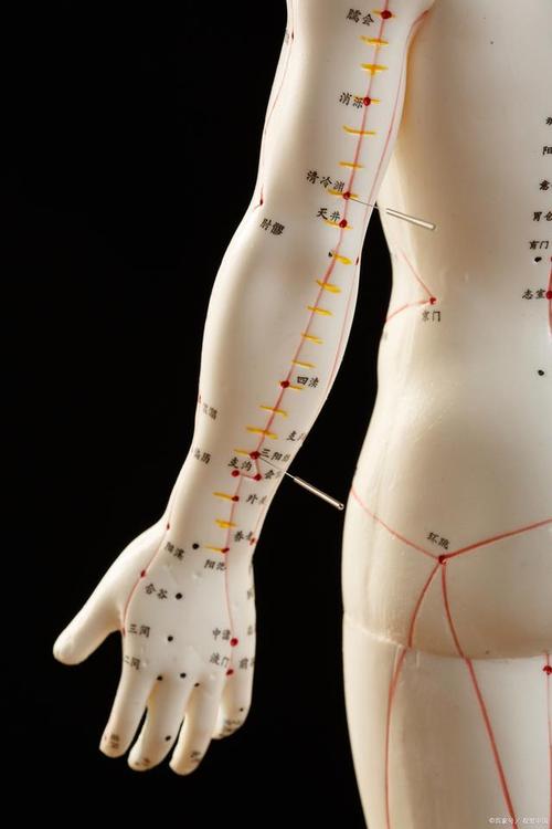 中医助理针灸80穴位