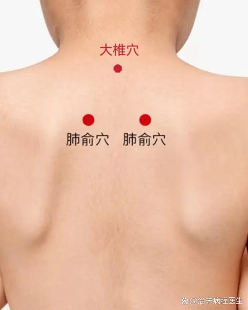 缓解感冒全身酸痛穴位