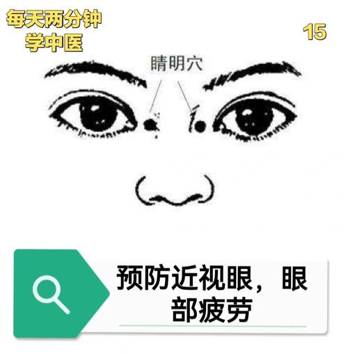 眼睛不好艾灸什么穴位