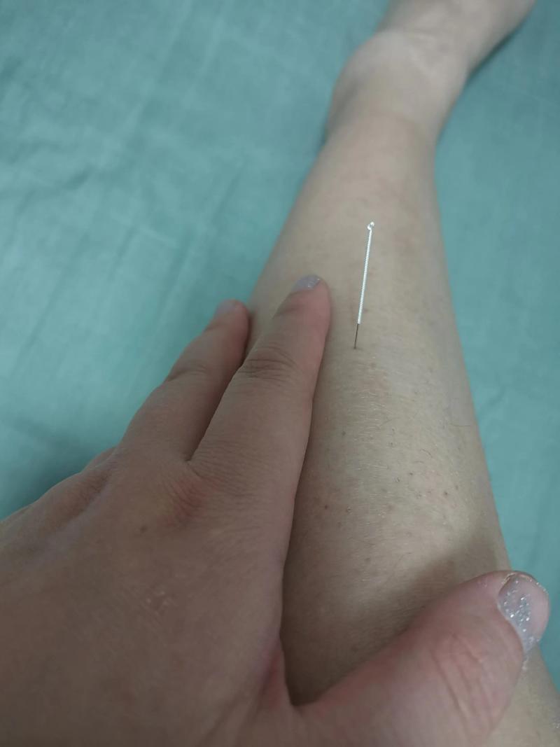 腘窝脓肿 针灸穴位