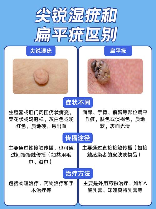扁平疣看中医还是西医