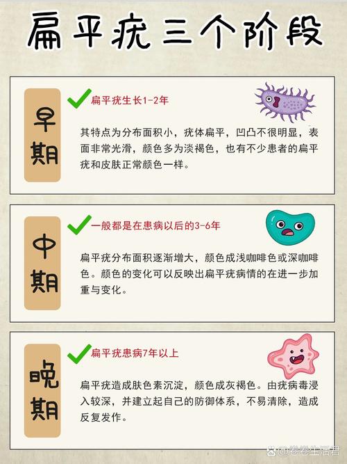 扁平疣看中医还是西医