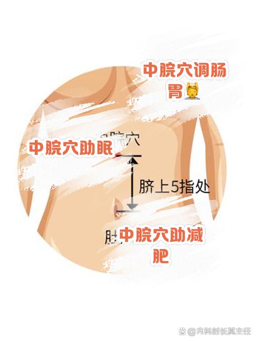 肚子胀气针灸哪个穴位