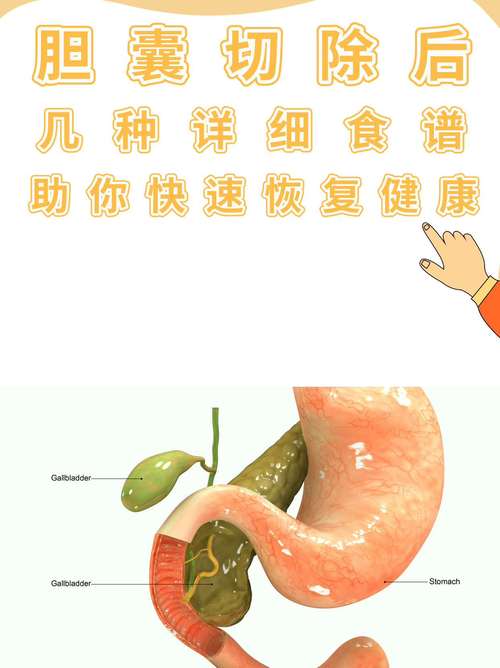 胆囊切除后一年的饮食