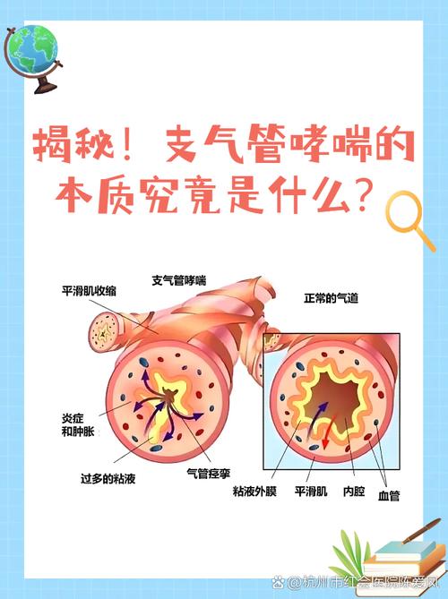 中医哮喘的原因是什么