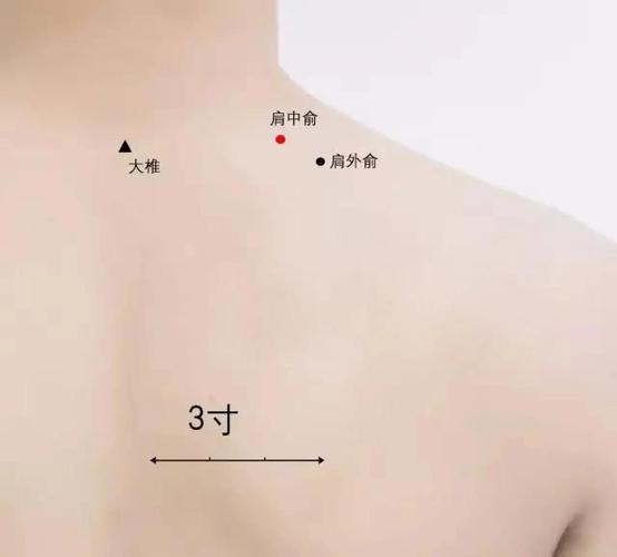 肩周炎艾灸灸哪些穴位