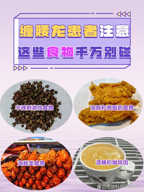 蛇缠腰在饮食上的禁忌