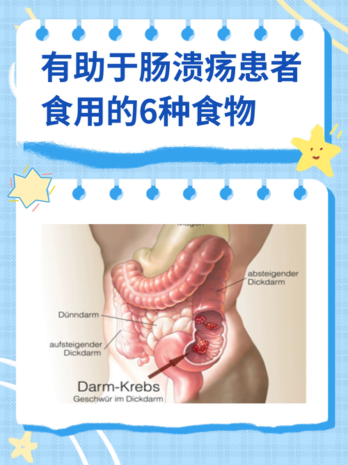 十二指肠溃疡术后饮食