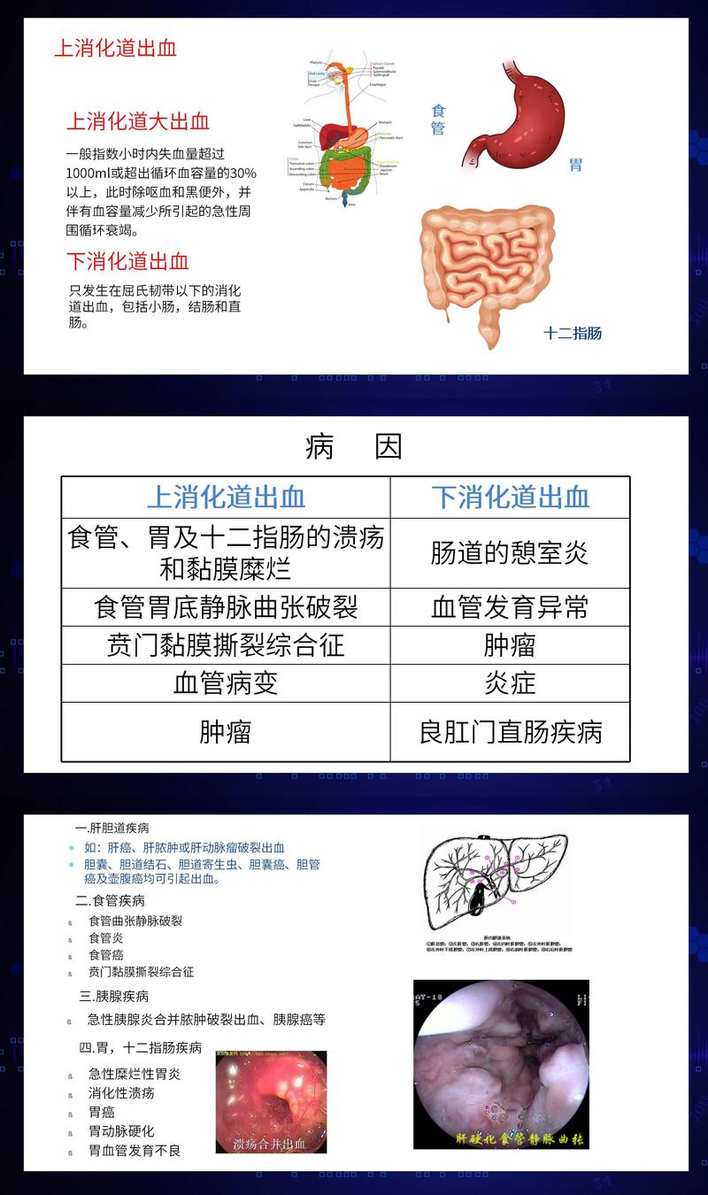 下消化道出血饮食护理