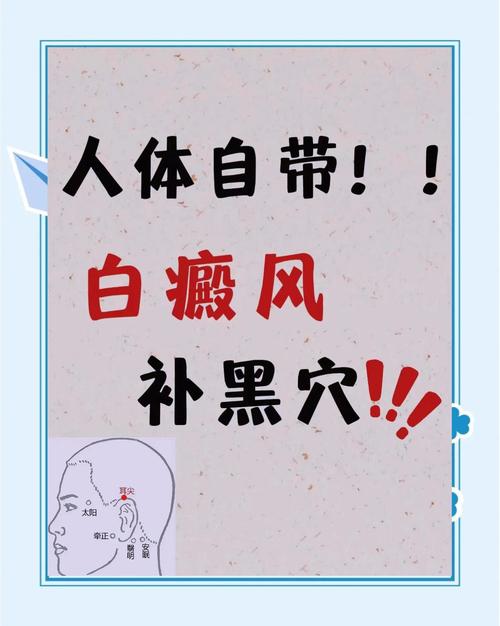 白癜风做艾灸哪个穴位