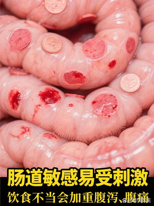 溃疡性结肠炎孕妇饮食