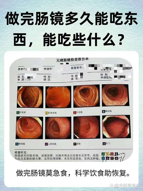 做完结肠镜后饮食事项