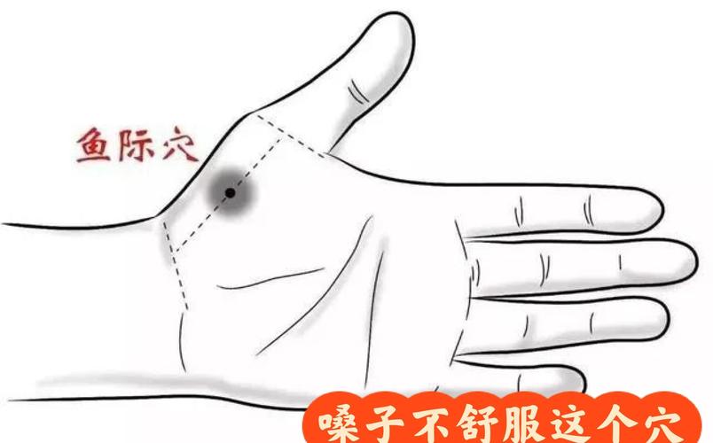 嗓子肿痛针灸什么穴位