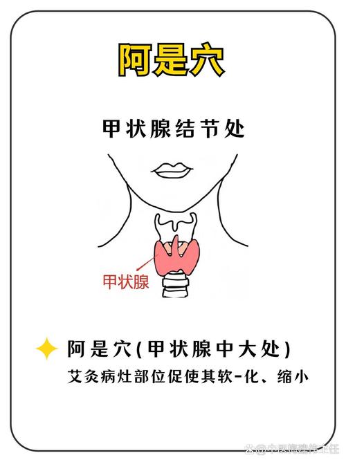 甲状腺腺瘤按什么穴位