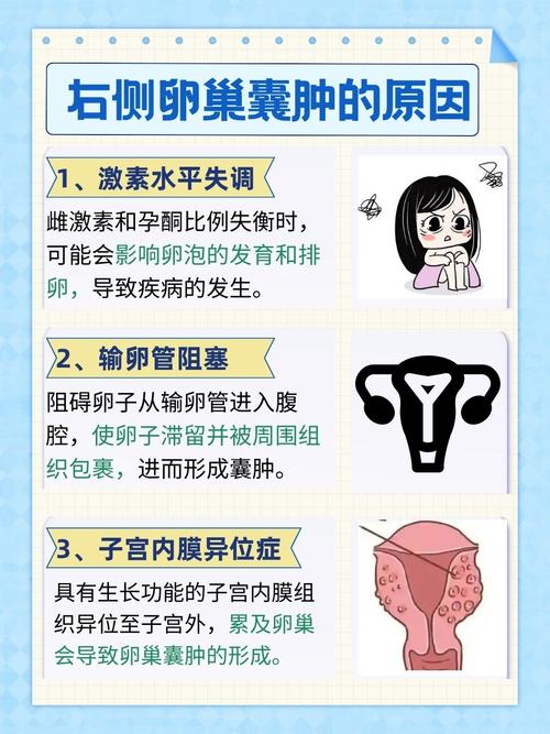 卵巢囊肿可以看中医吗