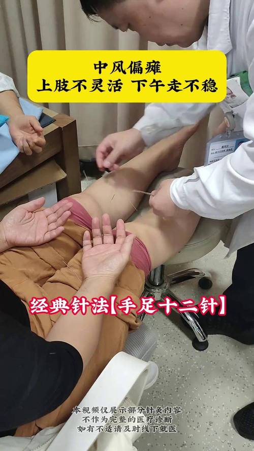 右侧偏瘫针灸哪些穴位