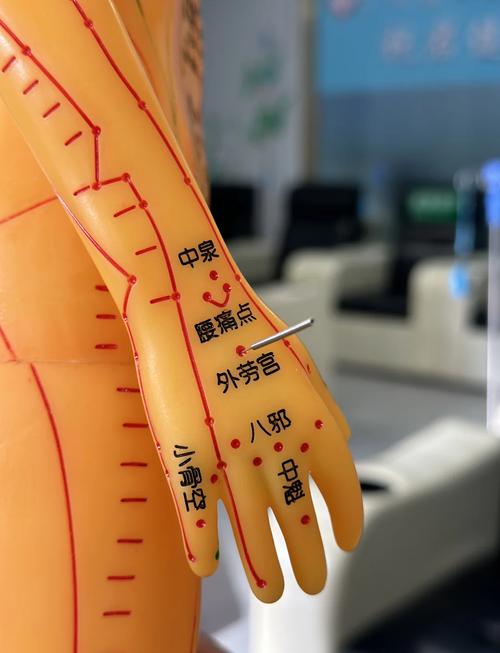 右侧偏瘫针灸哪些穴位