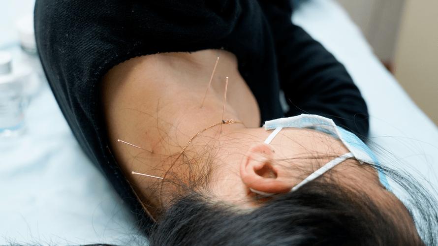 右侧偏瘫针灸哪些穴位