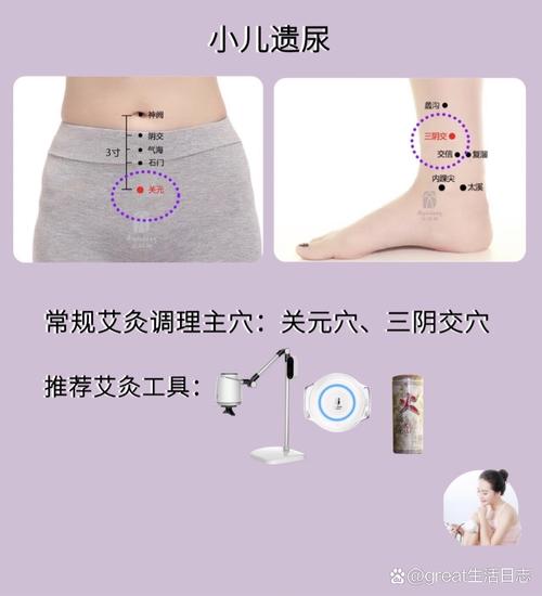 小儿尿床艾灸什么穴位