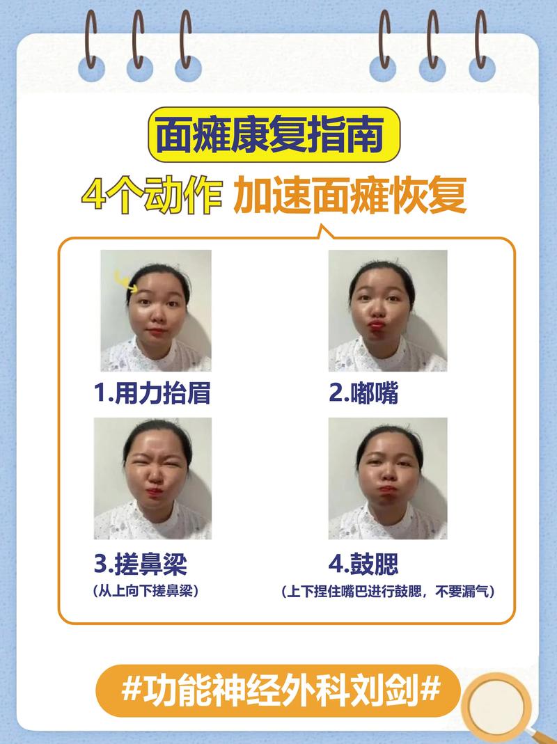 面神经痉挛的中医治疗