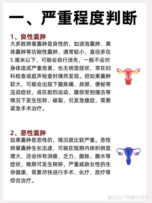 中医能治疗卵巢囊肿吗