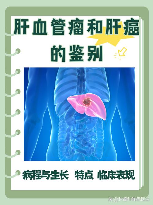 肝内血管瘤的饮食禁忌